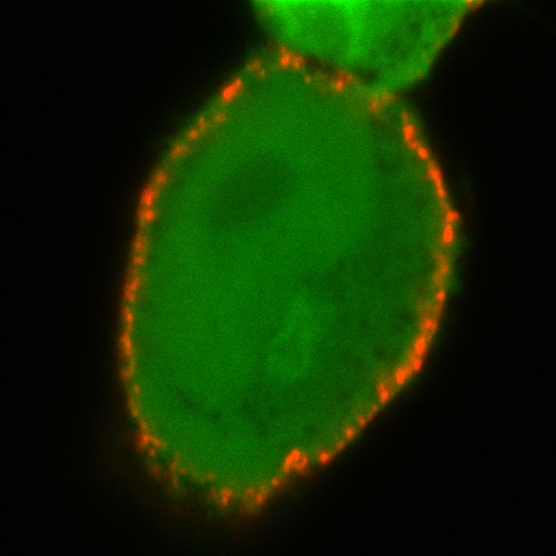  A human cell expressing both the SWELL1 (red) and green fluorescent protein. The red dots reveal the location of SWELL1 on the cell surface.