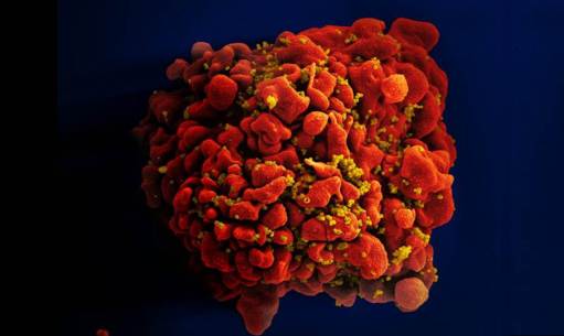 HIV-infected Immune Cell